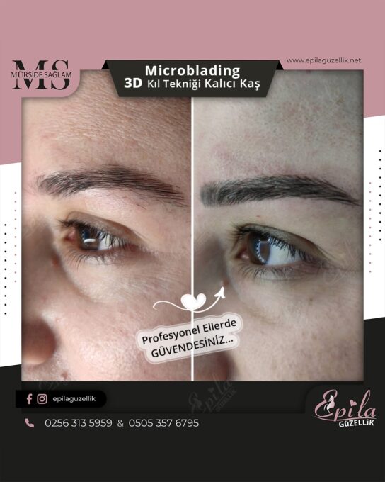 Nazilli - Microblading 3D Kıl Tekniği Kalıcı Kaş Kontürü