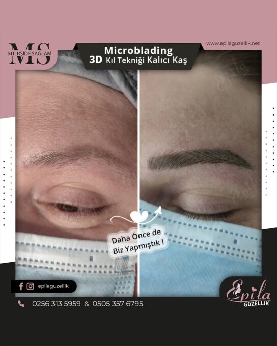 Nazilli - Microblading 3D Kıl Tekniği Kalıcı Kaş Kontürü