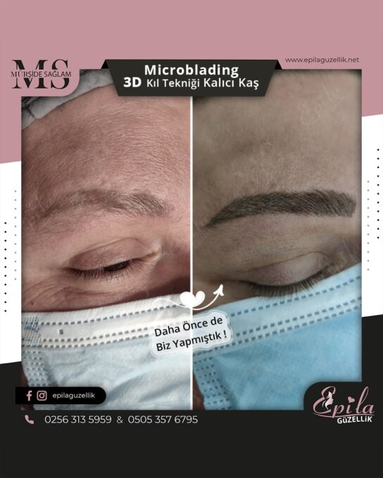 Nazilli - Microblading 3D Kıl Tekniği Kalıcı Kaş Kontürü