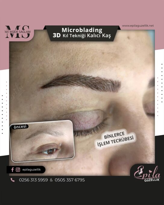 Nazilli - Microblading 3D Kıl Tekniği Kalıcı Kaş Kontürü