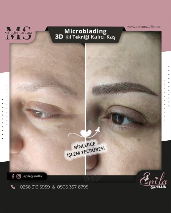 Nazilli - Microblading 3D Kıl Tekniği Kalıcı Kaş Kontürü