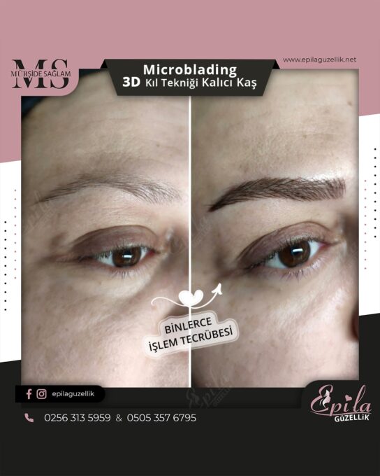 Nazilli - Microblading 3D Kıl Tekniği Kalıcı Kaş Kontürü