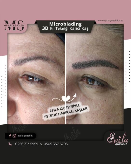 Nazilli - Microblading 3D Kıl Tekniği Kalıcı Kaş Kontürü