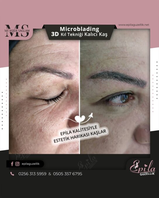 Nazilli - Microblading 3D Kıl Tekniği Kalıcı Kaş Kontürü