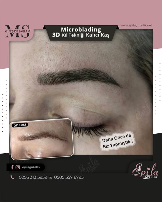 Nazilli - Microblading 3D Kıl Tekniği Kalıcı Kaş Kontürü