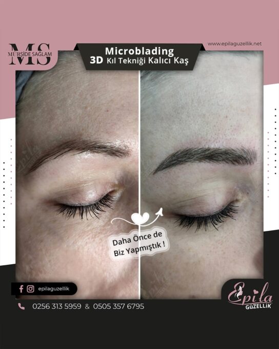 Nazilli - Microblading 3D Kıl Tekniği Kalıcı Kaş Kontürü