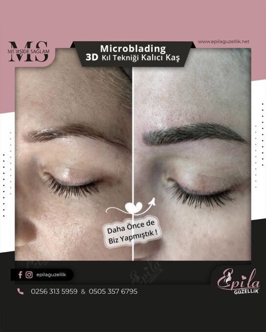 Nazilli - Microblading 3D Kıl Tekniği Kalıcı Kaş Kontürü