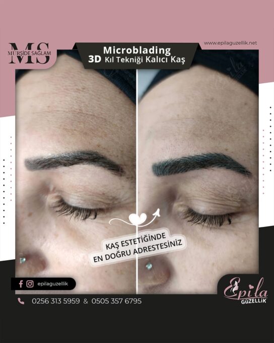 Nazilli - Microblading 3D Kıl Tekniği Kalıcı Kaş Kontürü