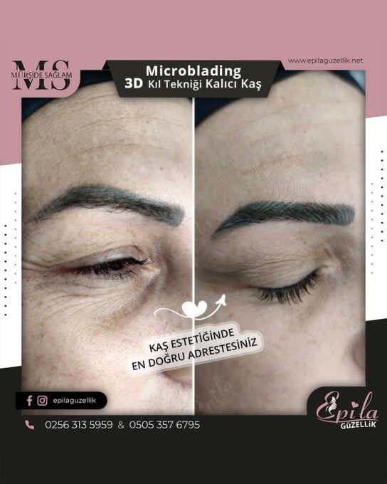 Nazilli - Microblading 3D Kıl Tekniği Kalıcı Kaş Kontürü