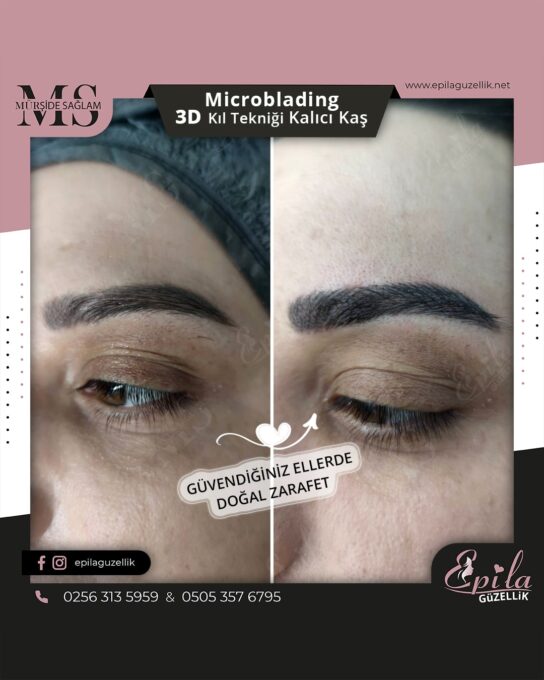 Nazilli - Microblading 3D Kıl Tekniği Kalıcı Kaş Kontürü