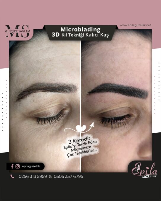 Nazilli - Microblading 3D Kıl Tekniği Kalıcı Kaş Kontürü