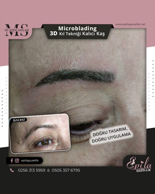 Nazilli - Microblading 3D Kıl Tekniği Kalıcı Kaş Kontürü