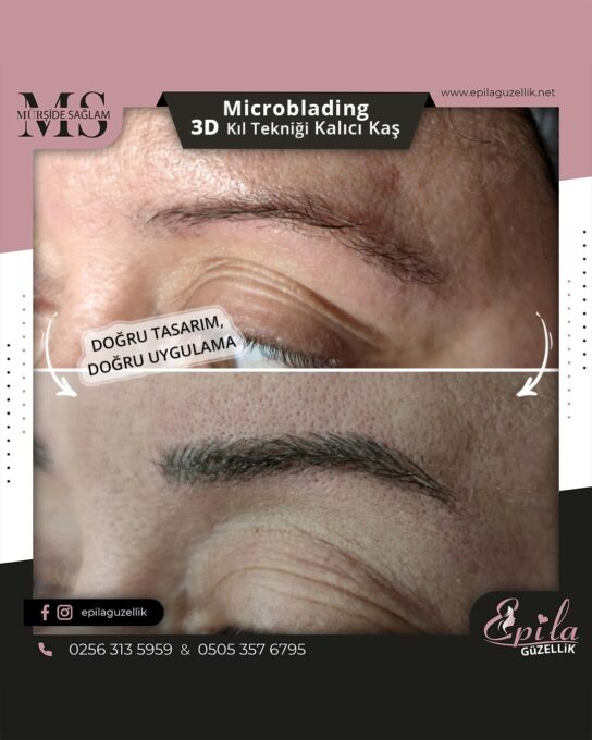 Nazilli - Microblading 3D Kıl Tekniği Kalıcı Kaş Kontürü