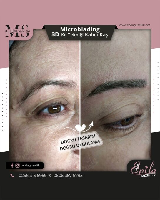 Nazilli - Microblading 3D Kıl Tekniği Kalıcı Kaş Kontürü