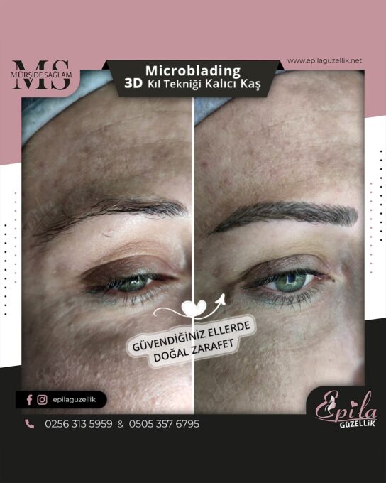 Nazilli - Microblading 3D Kıl Tekniği Kalıcı Kaş Kontürü