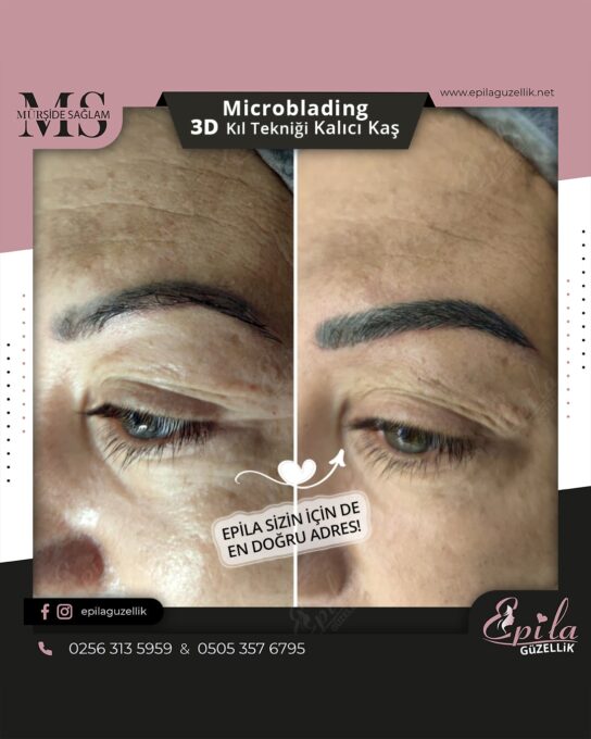 Nazilli - Microblading 3D Kıl Tekniği Kalıcı Kaş Kontürü