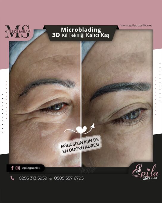 Nazilli - Microblading 3D Kıl Tekniği Kalıcı Kaş Kontürü