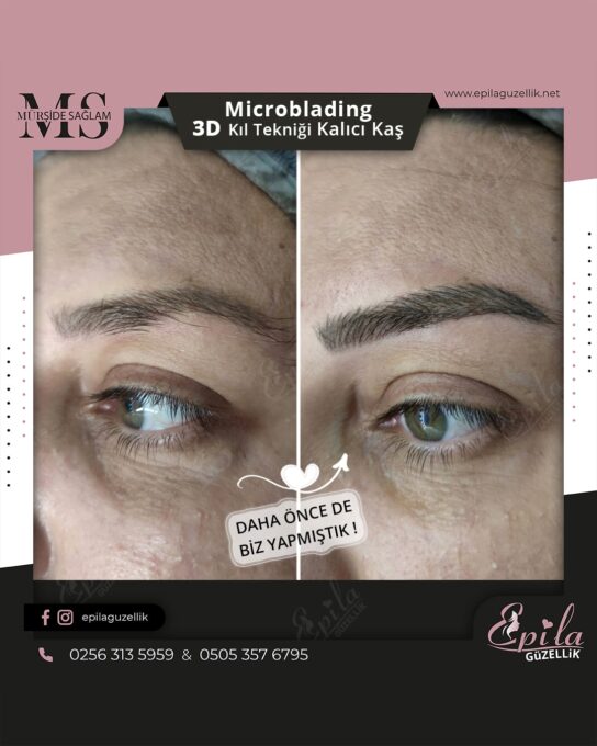 Nazilli - Microblading 3D Kıl Tekniği Kalıcı Kaş Kontürü