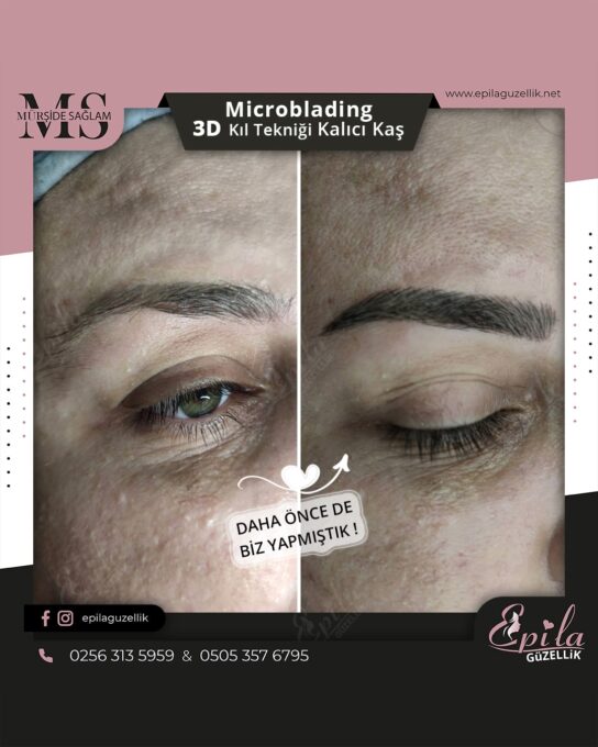 Nazilli - Microblading 3D Kıl Tekniği Kalıcı Kaş Kontürü