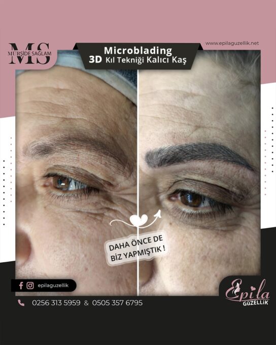 Nazilli - Microblading 3D Kıl Tekniği Kalıcı Kaş Kontürü