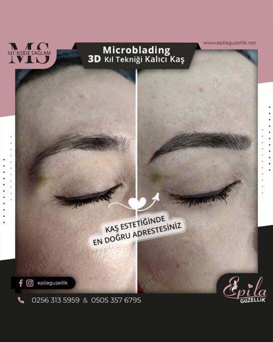 Nazilli - Microblading 3D Kıl Tekniği Kalıcı Kaş Kontürü