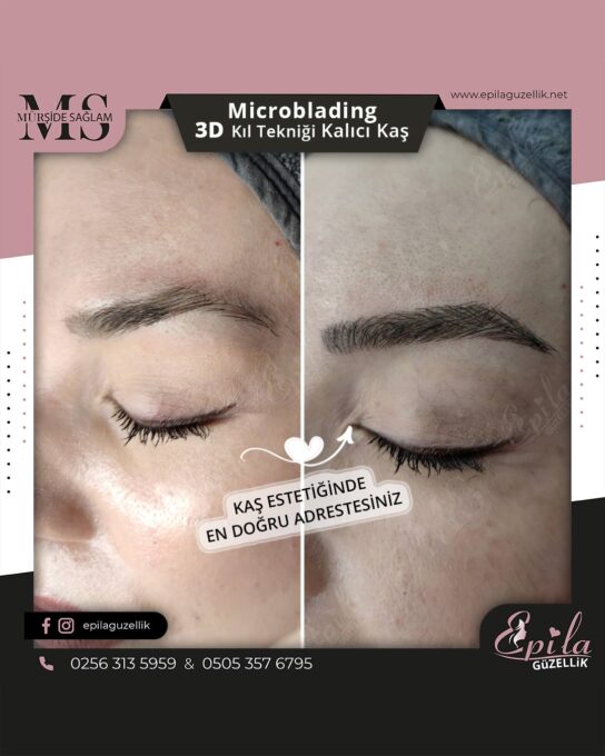 Nazilli - Microblading 3D Kıl Tekniği Kalıcı Kaş Kontürü