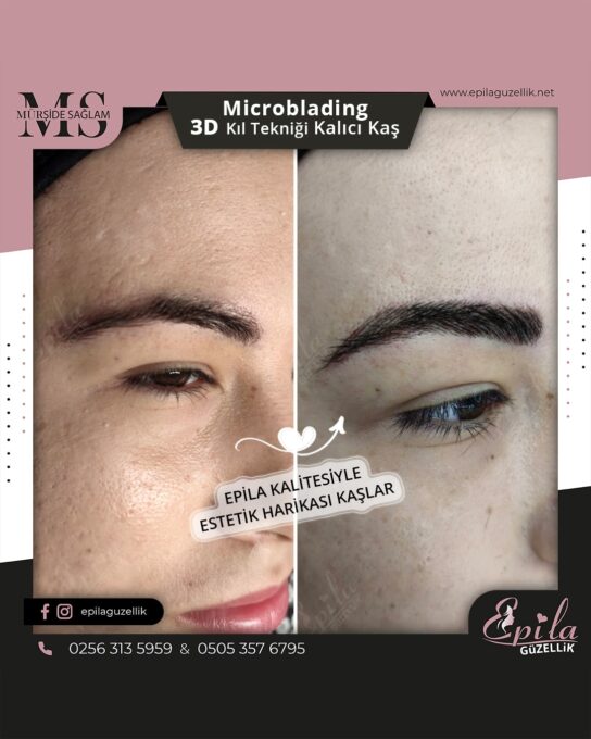 Nazilli - Microblading 3D Kıl Tekniği Kalıcı Kaş Kontürü