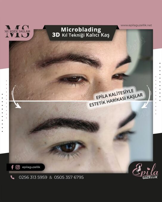 Nazilli - Microblading 3D Kıl Tekniği Kalıcı Kaş Kontürü