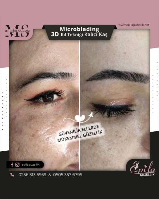 Nazilli - Microblading 3D Kıl Tekniği Kalıcı Kaş Kontürü