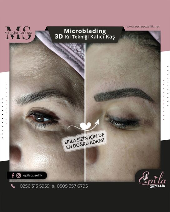 Nazilli - Microblading 3D Kıl Tekniği Kalıcı Kaş Kontürü