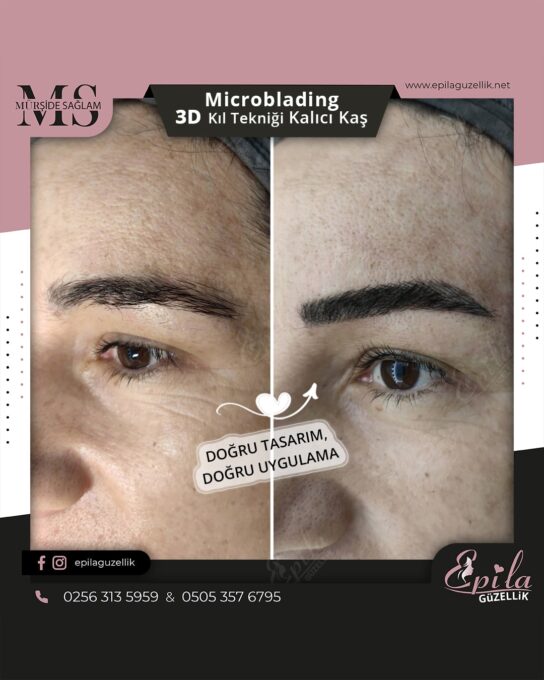 Nazilli - Microblading 3D Kıl Tekniği Kalıcı Kaş Kontürü