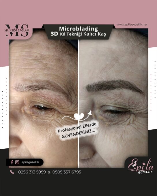 Nazilli - Microblading 3D Kıl Tekniği Kalıcı Kaş Kontürü