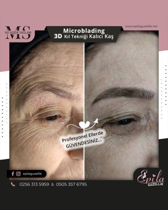 Nazilli - Microblading 3D Kıl Tekniği Kalıcı Kaş Kontürü