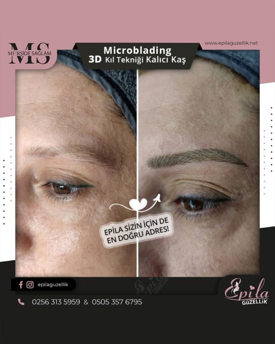 Nazilli - Microblading 3D Kıl Tekniği Kalıcı Kaş Kontürü