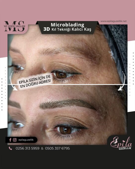 Nazilli - Microblading 3D Kıl Tekniği Kalıcı Kaş Kontürü