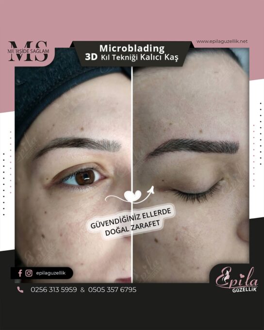 Nazilli - Microblading 3D Kıl Tekniği Kalıcı Kaş Kontürü