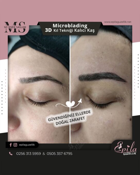 Nazilli - Microblading 3D Kıl Tekniği Kalıcı Kaş Kontürü