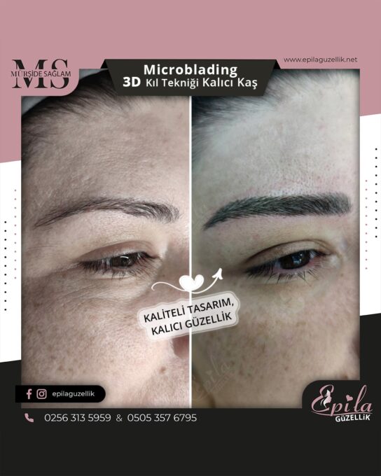 Nazilli - Microblading 3D Kıl Tekniği Kalıcı Kaş Kontürü