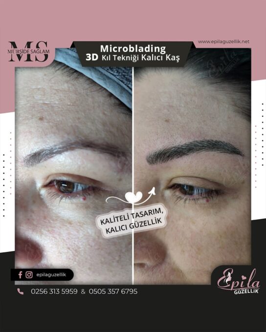 Nazilli - Microblading 3D Kıl Tekniği Kalıcı Kaş Kontürü