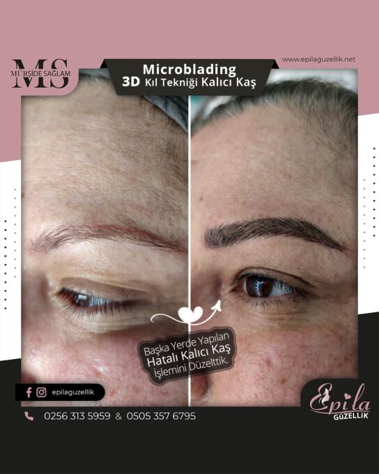 Nazilli - Microblading 3D Kıl Tekniği Kalıcı Kaş Kontürü