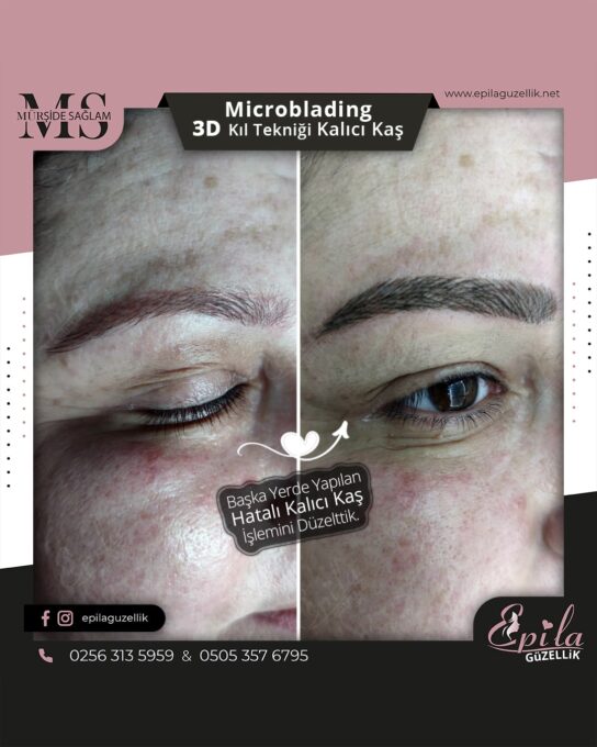 Nazilli - Microblading 3D Kıl Tekniği Kalıcı Kaş Kontürü