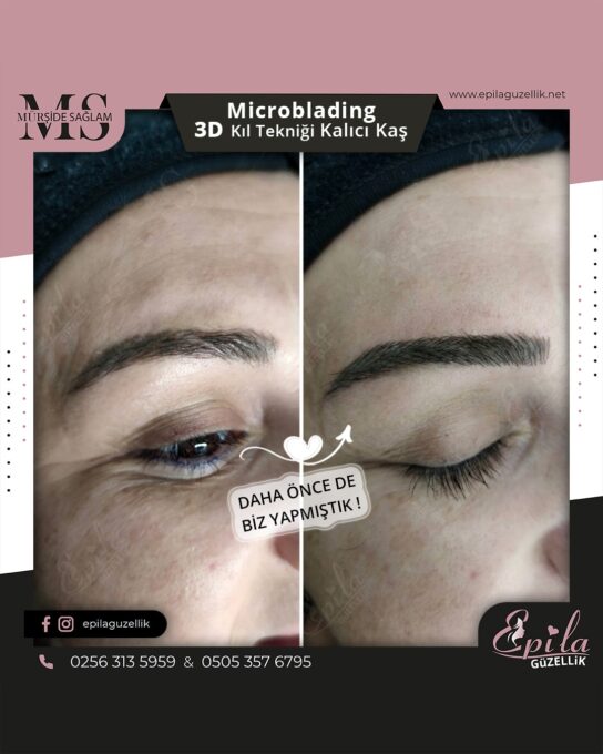 Nazilli - Microblading 3D Kıl Tekniği Kalıcı Kaş Kontürü