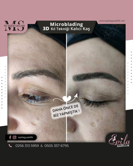 Nazilli - Microblading 3D Kıl Tekniği Kalıcı Kaş Kontürü