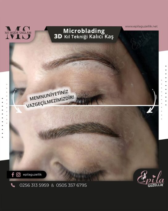 Nazilli - Microblading 3D Kıl Tekniği Kalıcı Kaş Kontürü