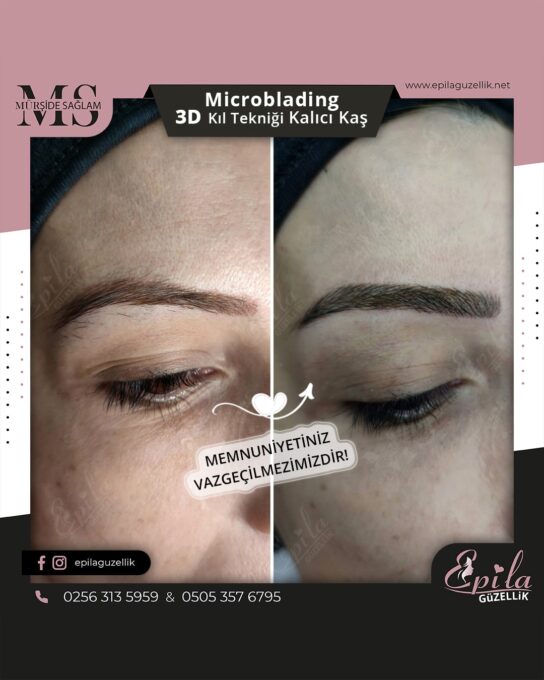 Nazilli - Microblading 3D Kıl Tekniği Kalıcı Kaş Kontürü