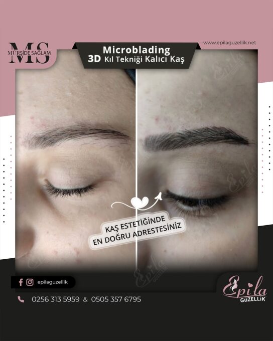 Nazilli - Microblading 3D Kıl Tekniği Kalıcı Kaş Kontürü