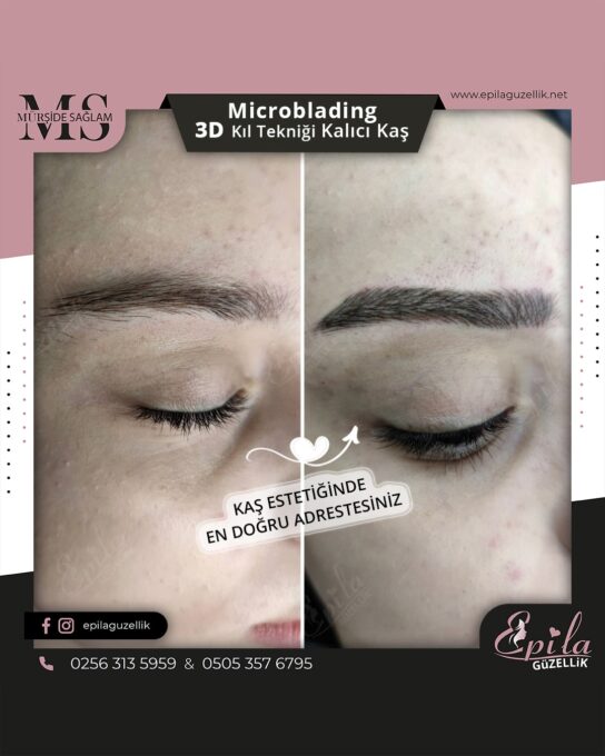 Nazilli - Microblading 3D Kıl Tekniği Kalıcı Kaş Kontürü