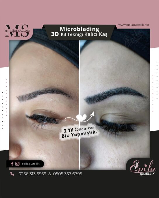 Nazilli - Microblading 3D Kıl Tekniği Kalıcı Kaş Kontürü