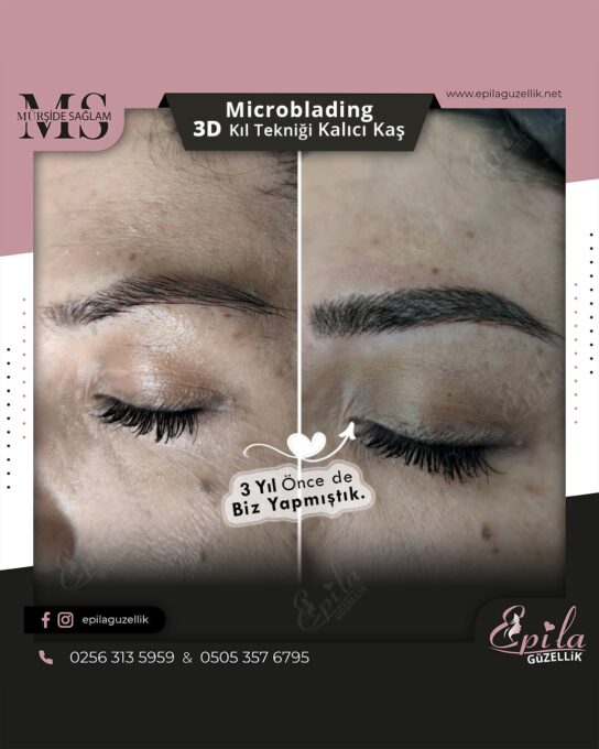 Nazilli - Microblading 3D Kıl Tekniği Kalıcı Kaş Kontürü