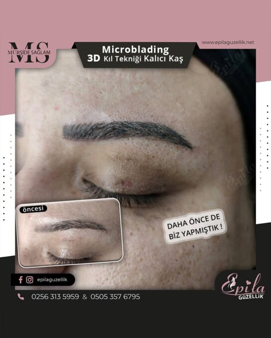 Nazilli - Microblading 3D Kıl Tekniği Kalıcı Kaş Kontürü